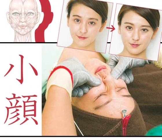 【小顔施術をやってみた】顔の歪みが一気に解消!!