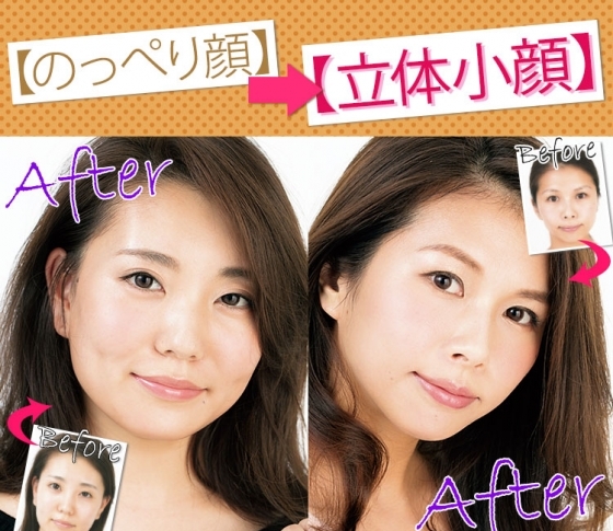 【のっぺり顔】を立体小顔にするツヤ盛り【コントゥアテク】とは?
