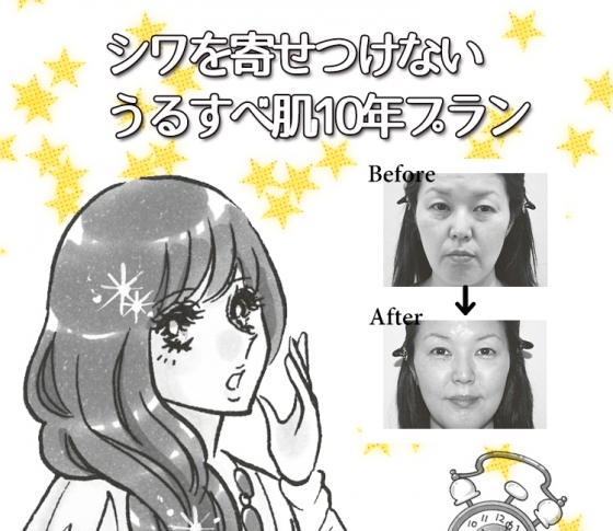 シワっぽくなりがちな人が30代からできる美容医療10年プラン