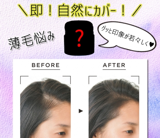 【薄毛悩み】透けてみえる頭皮を、即!自然にカバーしてくれるアイテムとは?!