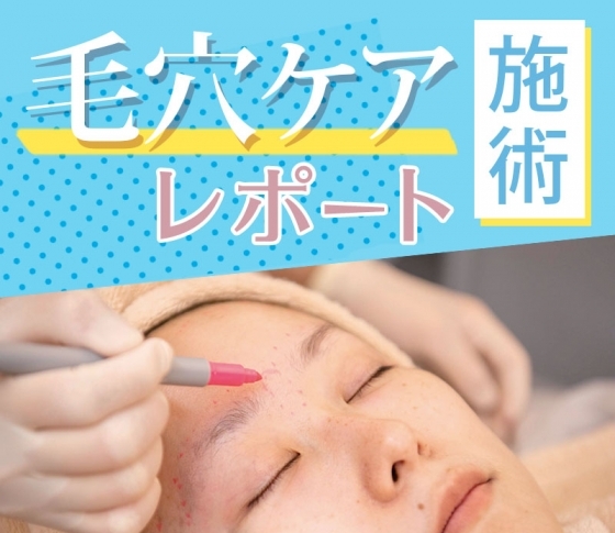 プロの【毛穴ケア】体験レポ|【たるみ改善、毛穴レス】etc.……は本当に叶う?