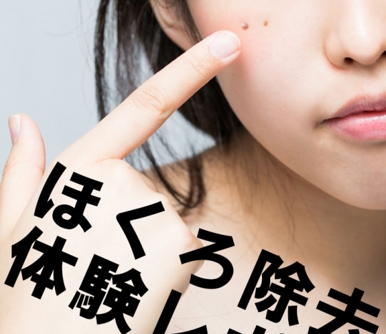 【ほくろ除去】レーザーで簡単! ほくろを取って美人度&美肌感をアップ