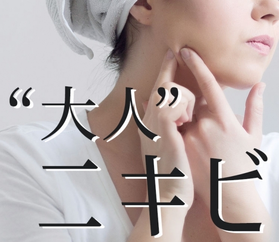 皮膚科医に聞いた【大人ニキビの原因・直し方】鼻・頬・おでこ・あごetc. 【ニキビ菌は悪くない?】
