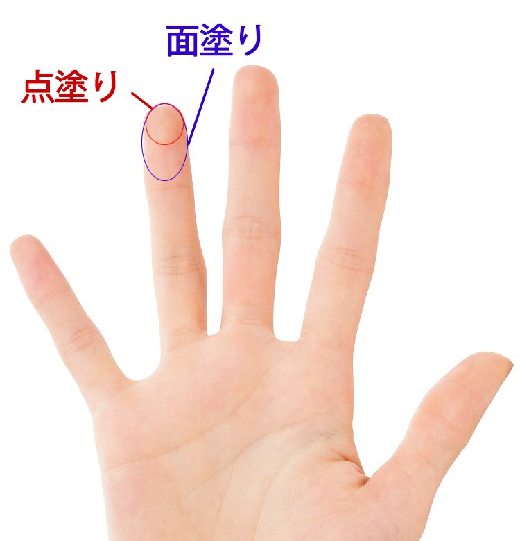 Image title